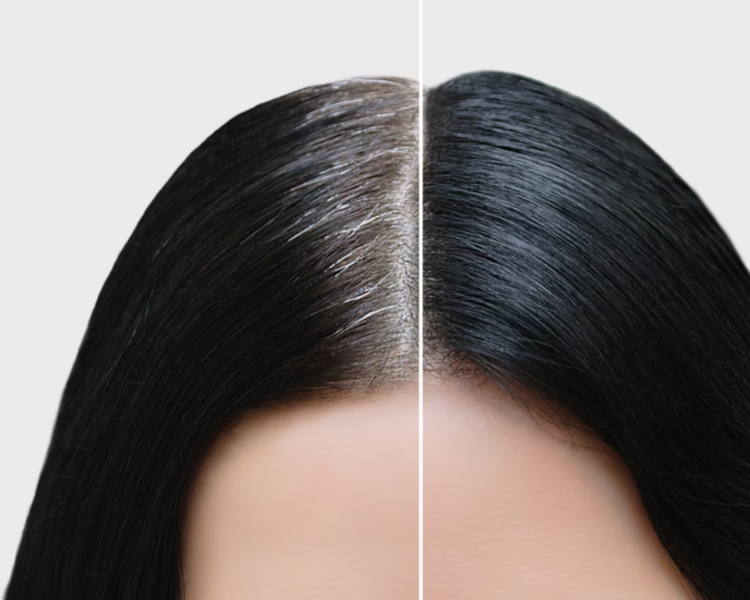 RAIZ O COBERTURA DE CANAS 
