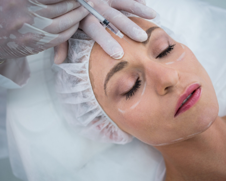 💉Toxina Botulínica – Tercio Superior Facial (4 Zonas + Retoque)