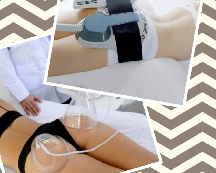 Tratamiento levanta glúteos más celulitis muslo por posterior 