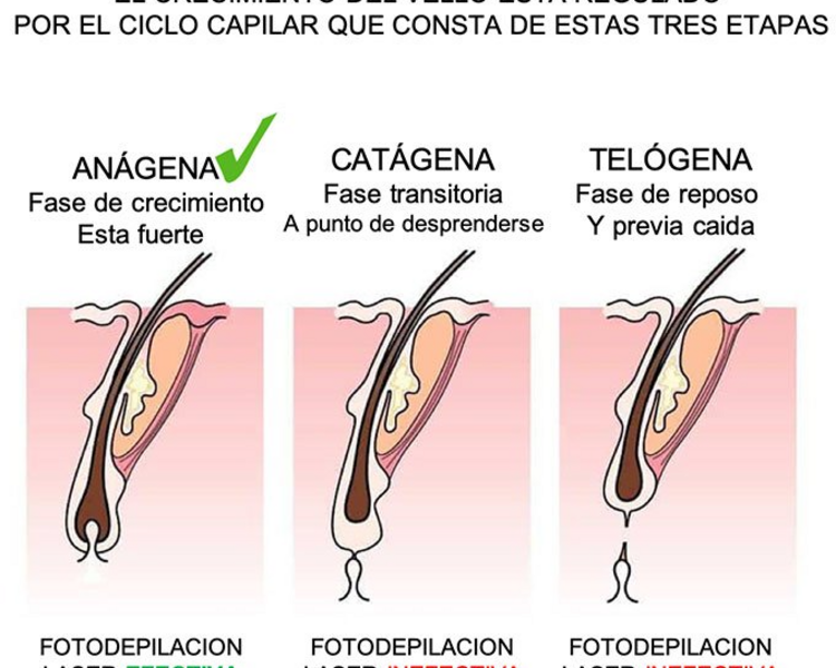 DL- Espalda completa
