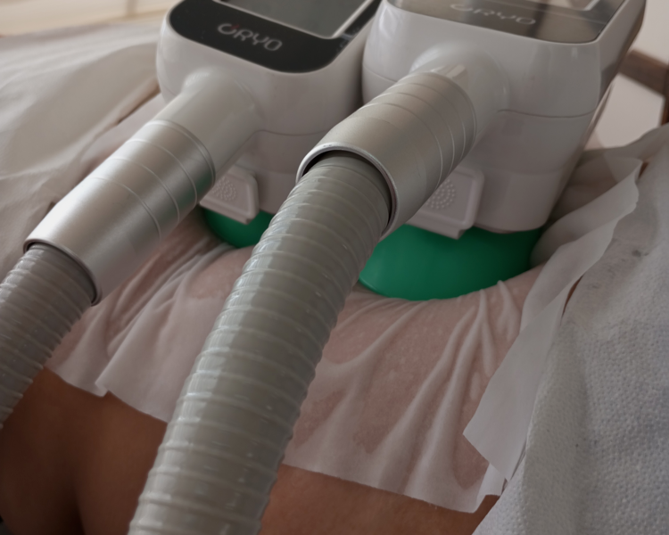 Tratamiento Reductivo con Criolipólisis 