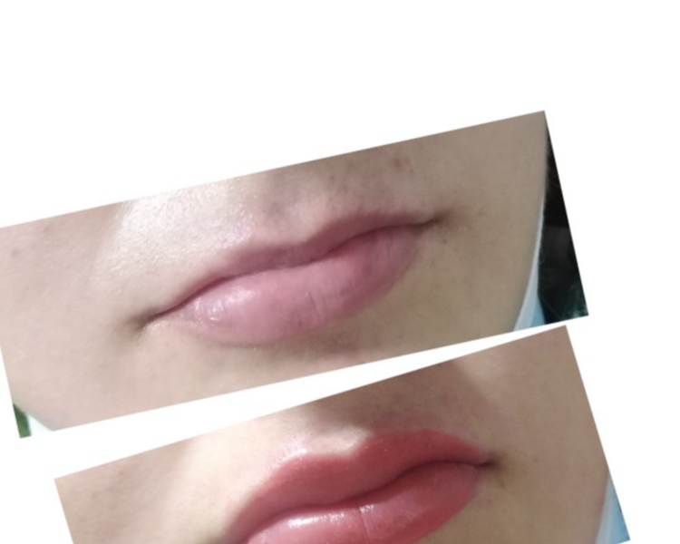 Micropigmentación de labios 