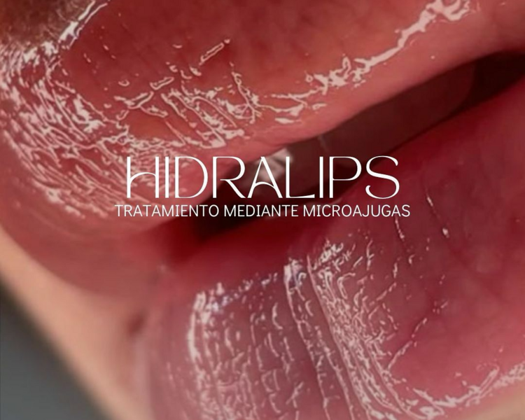 Hidralips