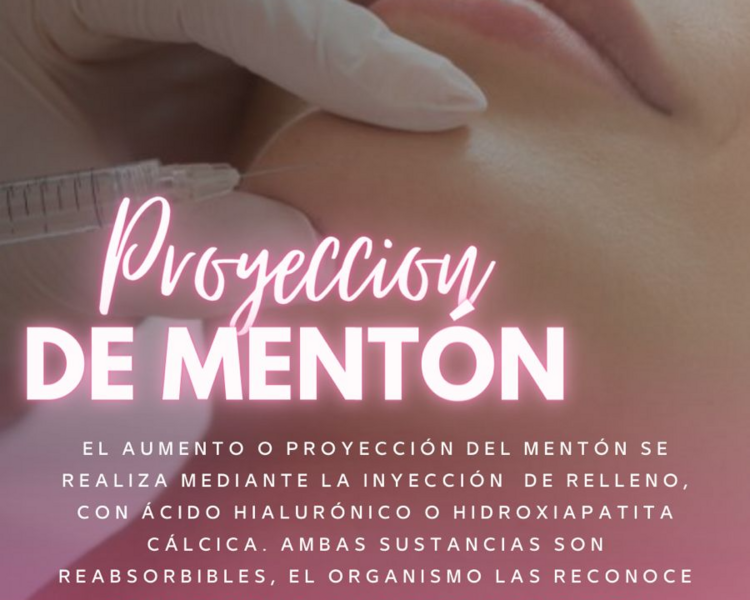 Proyeccion De Menton 