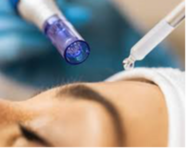 Restauración de cejas-Revival