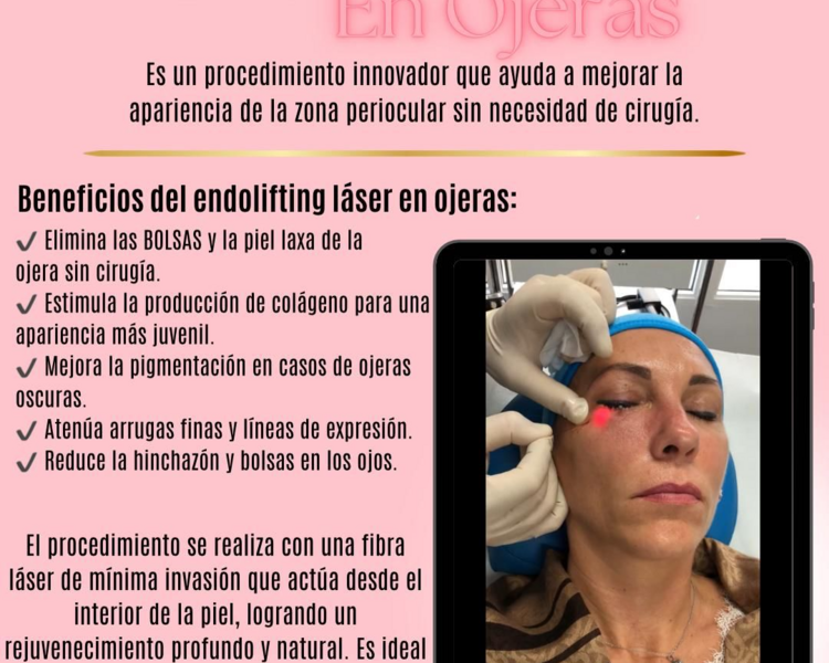 Endolifting Ojeras 
