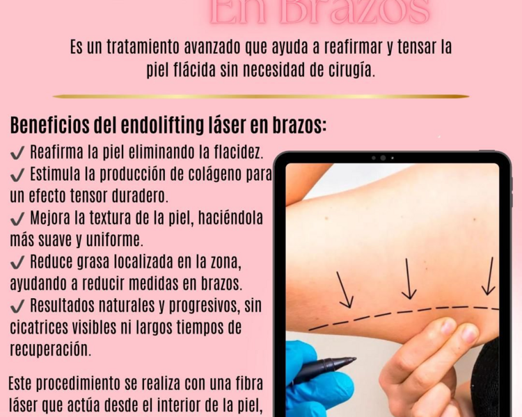 Endolifting Brazos