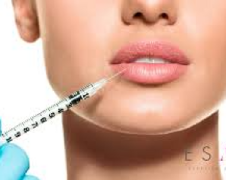 Perfilado de labios (1ml)