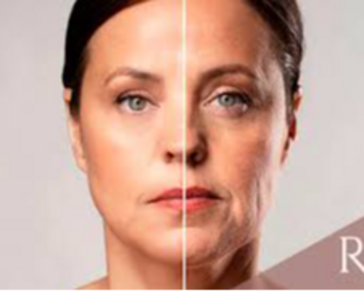 Cientific (bioestimulacion con Hidroxiapatita de Calcio)