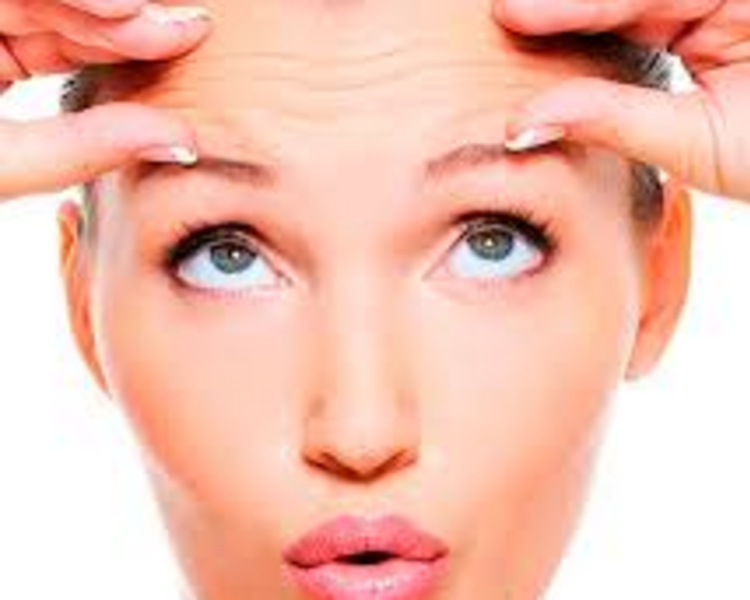Botox 3 zonas