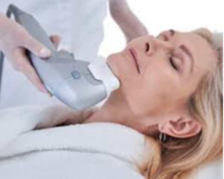Hifu facial 12D rostro Completo (2 sesiones)