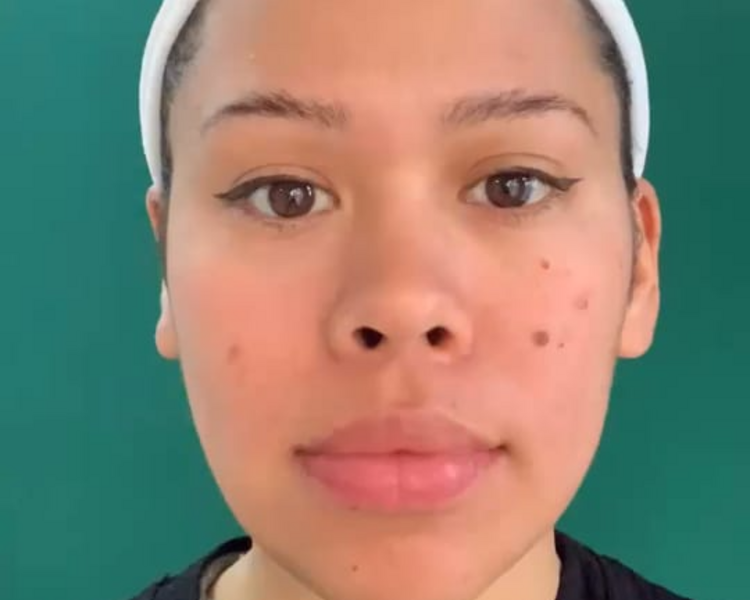 Glow & Lift – Terapia Facial