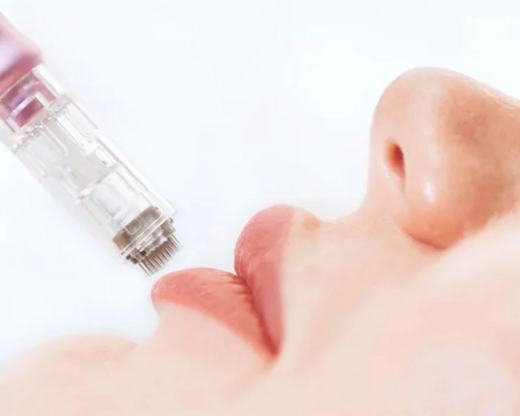 💋 Hidralips con Dermapen (*Servicio exclusivo como complemento de algún tratamiento)