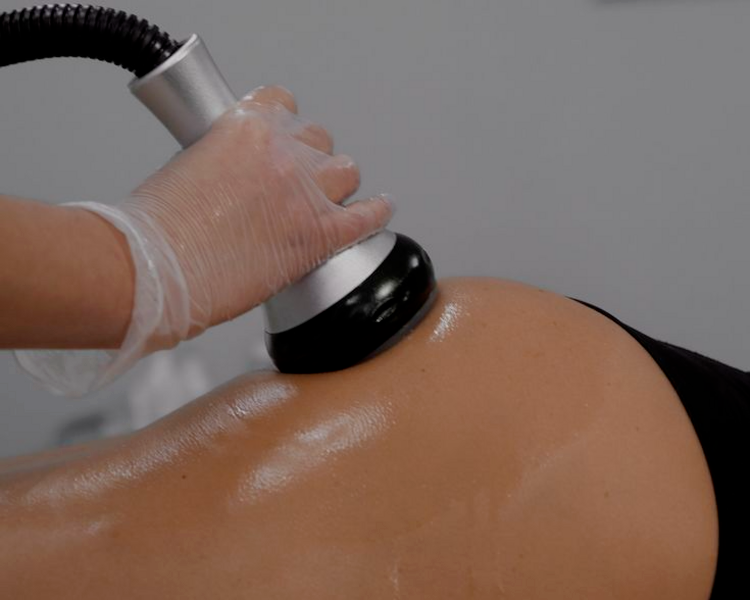 10 sesiones Quemador de grasa en 1 zona