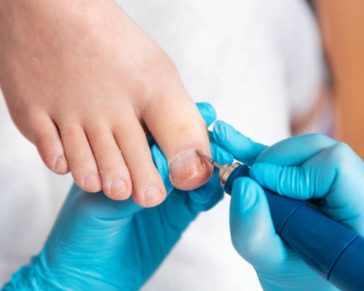 1° vez Servicio Podologico Integral