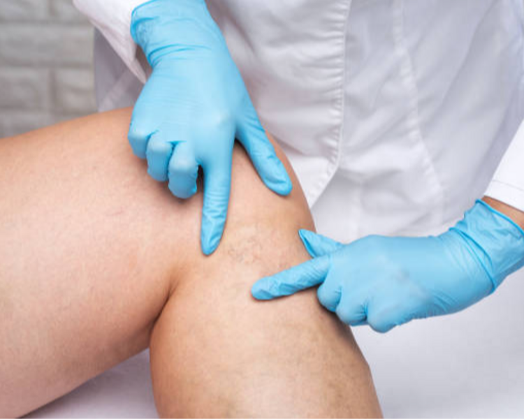 Valoración  de 1° vez  Preventiva