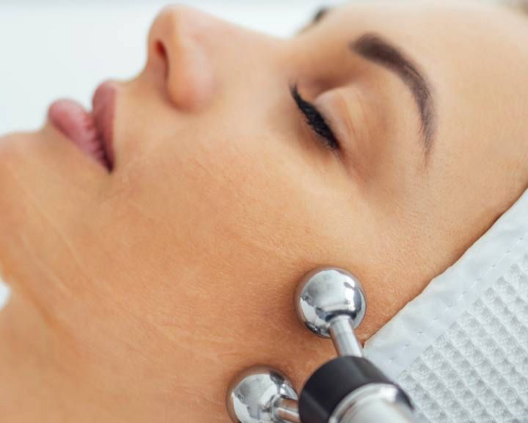 3 sesiones lifting facial