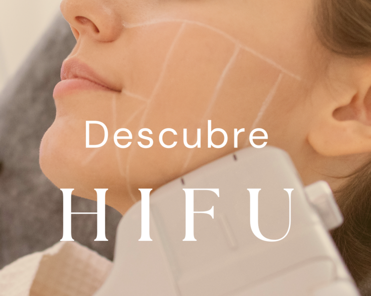 HIFU Zona Patas de gallo