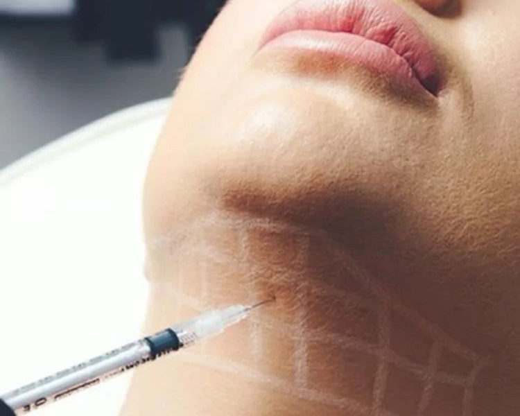 Lipopapada sin cirugía (1 sesión)