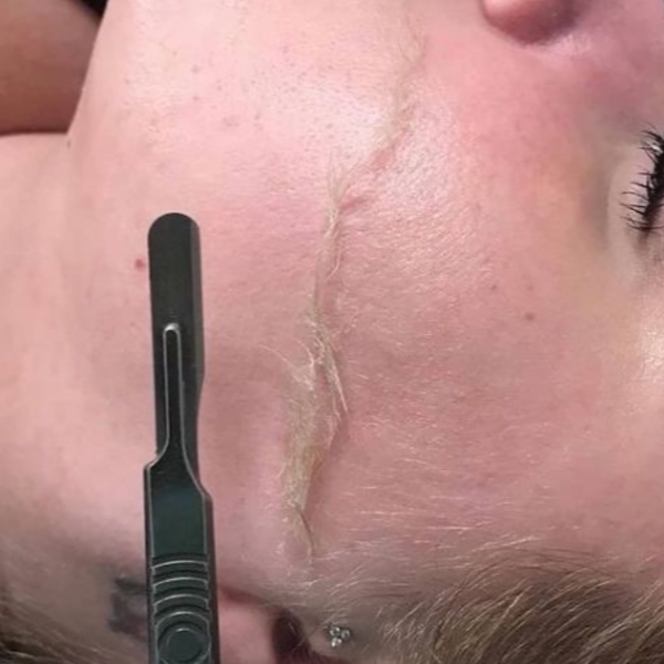 Limpieza Facial Profunda + Dermaplaning