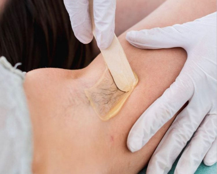 Epilación de axilas con cera