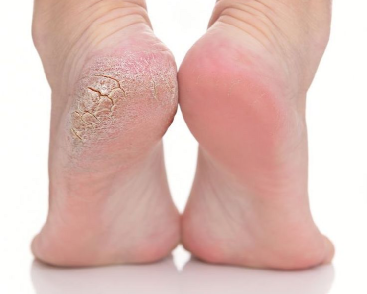 Pedicure + Semipermante