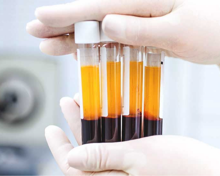 Plasma rico en plaquetas + Pink Glow 