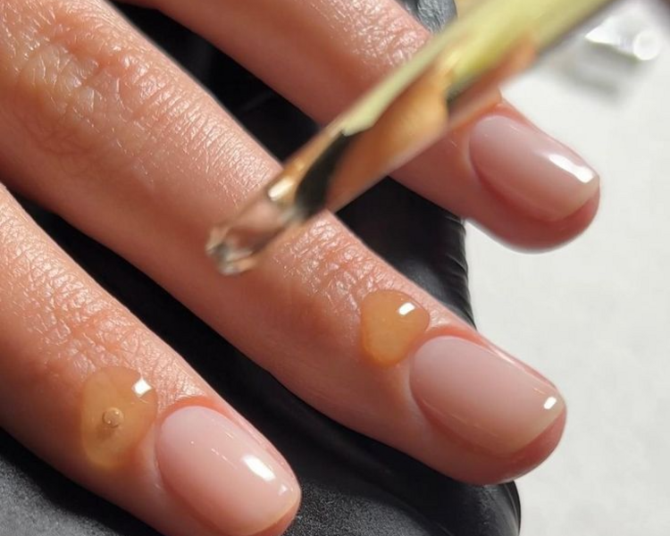 Tratamiento Recuperador