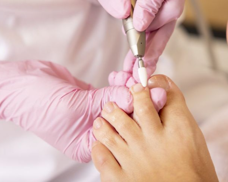 Retiro de Semipermanente en pies