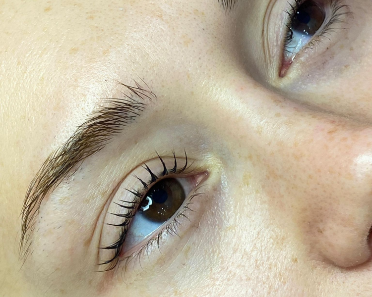 Combo Perfilado + Lifting