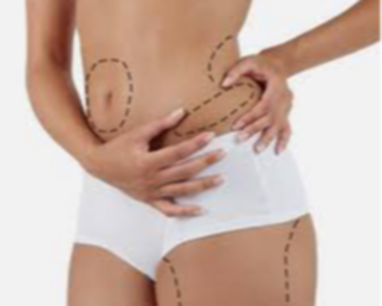 Lipo Química