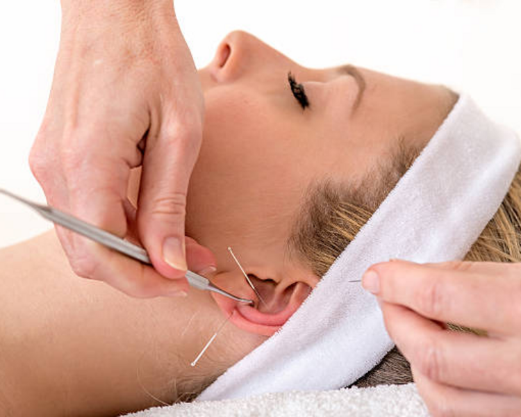 Auriculoterapia con Electroestimulación y Semillas
