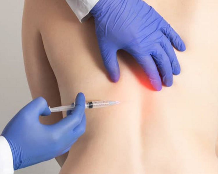 Tratamiento para el Dolor – Ozonoterapia