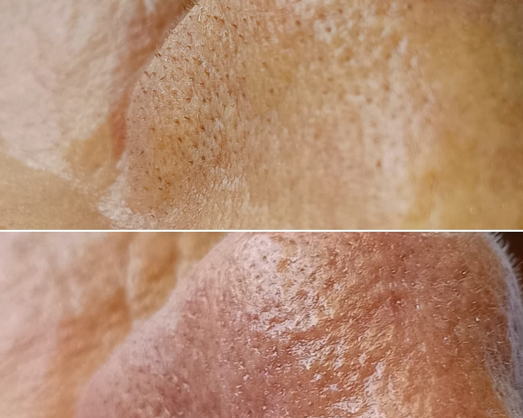 Limpieza profunda facial (ROSTRO,CUELLOY ESCOTE)