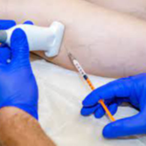 ESCLEROTERAPIA + ECOGRAFIA