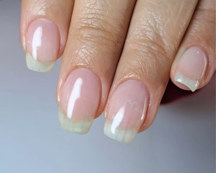 Nivelación (Adicionado a Esmalte Permanente)