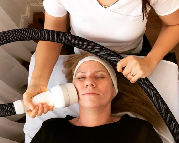 Crioradiofrecuencia facial