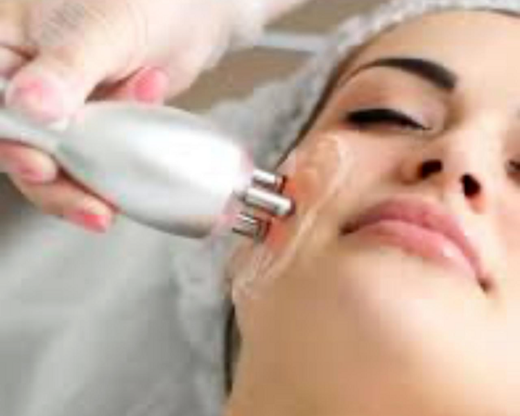 Radiofrecuencia facial ( 4 sesiones)