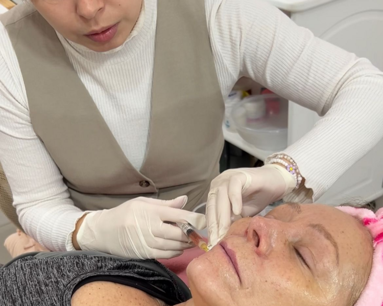 Hilos tensores: Monofilamento (x10)