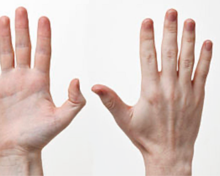 HIFU Manos (2 sesiones)