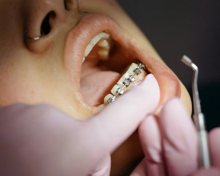 Ortodoncia - consulta 