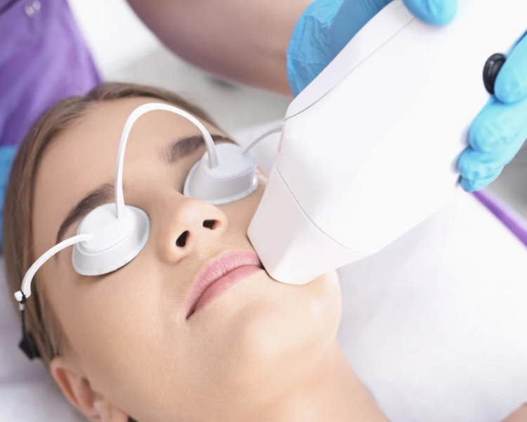 Rostro completo (mujer) 6 sesiones