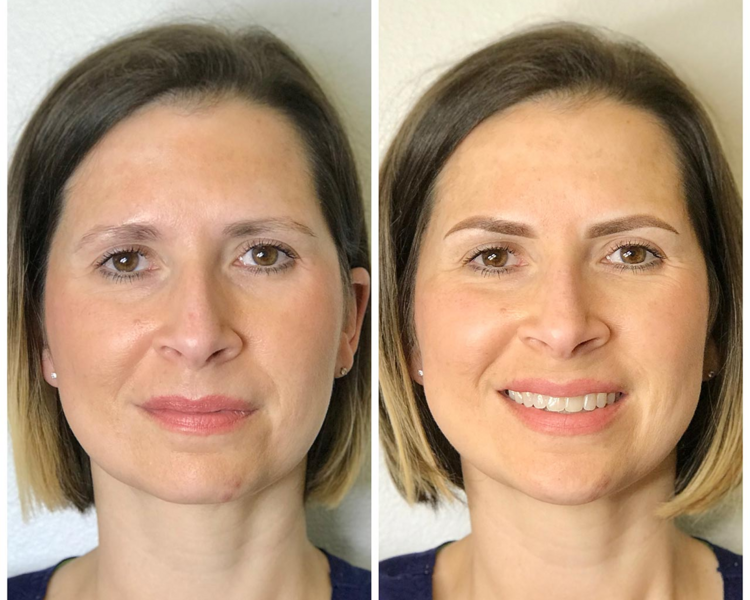 Micropigmentación - Cejas Efecto Polvo