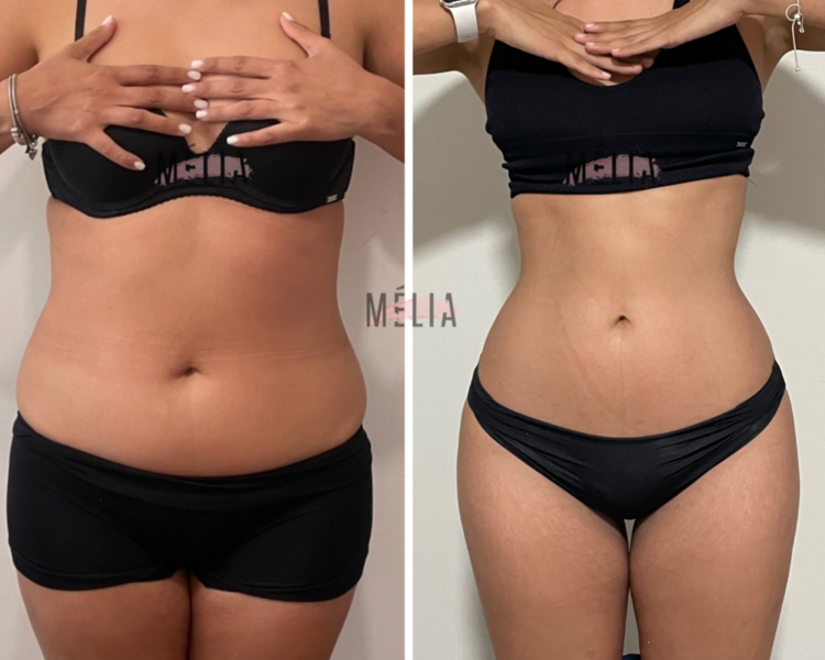 Cinturita Colombiana 🇨🇴