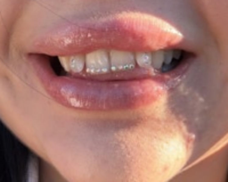 Joya dental diseños 