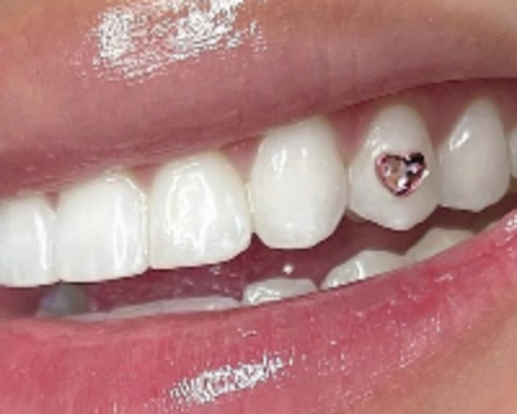 Joya dental 1 Cristal pequeno 