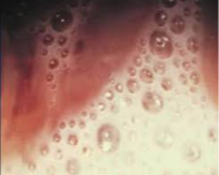 Toma de examenes Ginecológicos 