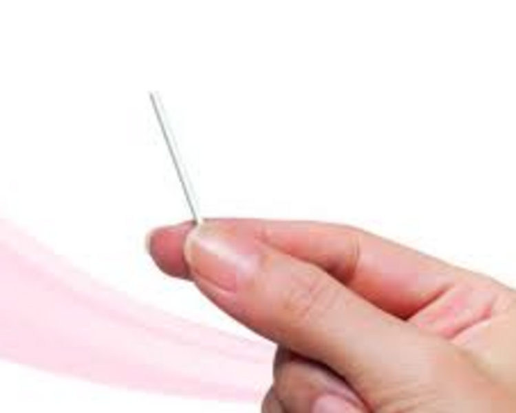 Extracción de Implanon