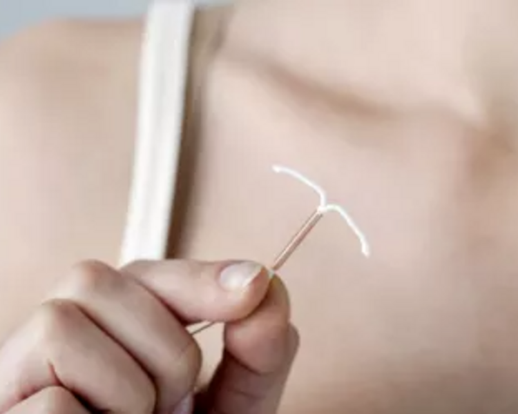 Inserción o recambio de Dispositivo intrauterino (inlcuye dispositivo Andalan variedades classic, silverflex, comfort, comfort mini)