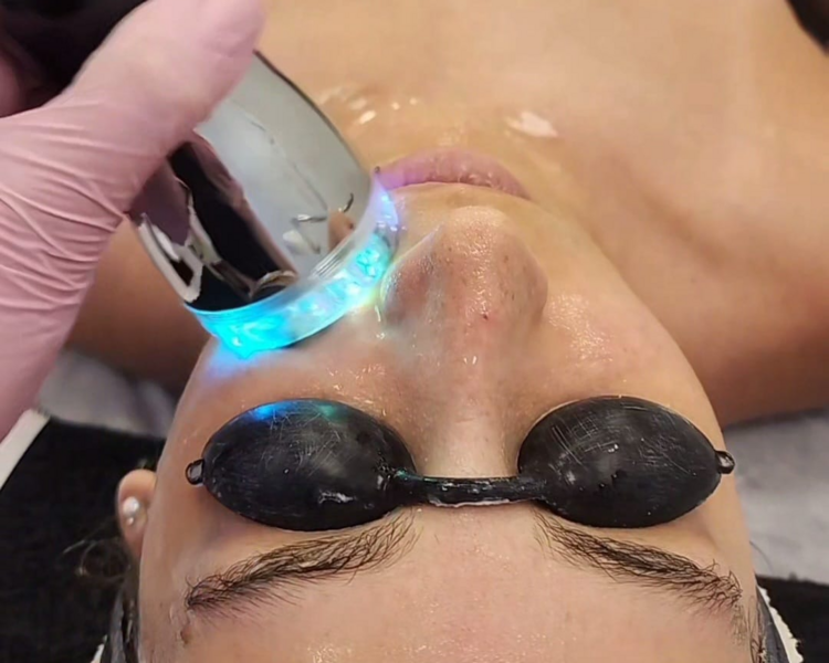 TRATAMIENTO SOFT SKIN